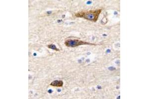 Image no. 2 for anti-Cytochrome P450, Family 2, Subfamily R, Polypeptide 1 (CYP2R1) (Middle Region) antibody (ABIN360263)