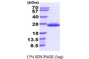 SDS-PAGE (SDS) image for Dual Specificity Phosphatase 18 (DUSP18) (AA 1-188) (Active) protein (His tag) (ABIN6388006) (DUSP18 Protein (AA 1-188) (His tag))