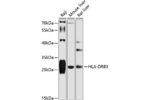 Western blot analysis of extracts of various cell lines, using HLA-DRB3 antibody (ABIN6131761, ABIN6141833, ABIN6141834 and ABIN6216072) at 1:1000 dilution.