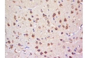 Paraformaldehyde-fixed, paraffin embedded rat brain tissue, Antigen retrieval by boiling in sodium citrate buffer(pH6) for 15min, Block endogenous peroxidase by 3% hydrogen peroxide for 30 minutes, Blocking buffer (normal goat serum) at 37°C for 20min, Antibody incubation with Rabbit Anti-SULT4A1 Polyclonal Antibody, Unconjugated  at 1:500 overnight at 4°C, followed by a conjugated secondary and DAB staining (SULT4A1 antibody  (AA 221-284))