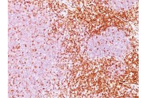 Image no. 1 for anti-CD6 (CD6) antibody (ABIN6160102) (CD6 antibody)