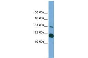 Image no. 1 for anti-Interleukin 1 delta (FIL1d) (C-Term) antibody (ABIN6745104) (FIL1d antibody  (C-Term))