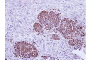 IHC-P Image Immunohistochemical analysis of paraffin-embedded NCIN87 xenograft, using ZNF259, antibody at 1:500 dilution. (ZNF259 antibody  (Center))