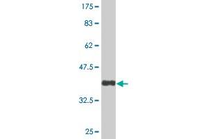 Western Blot detection against Immunogen (36. (TSPYL1 antibody  (AA 1-100))