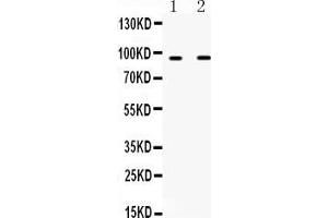 Western blot analysis of IFNGR1 using anti-IFNGR1 antibody . (IFNGR1 antibody  (C-Term))