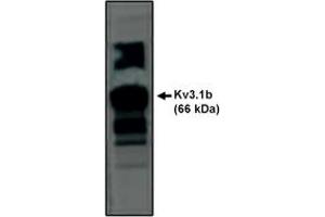 Image no. 1 for anti-Potassium Voltage-Gated Channel, Shaw-Related Subfamily, Member 1 (KCNC1) antibody (ABIN201687)