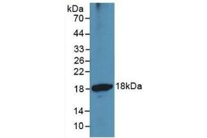 Detection of Recombinant ADAMTS1, Human using Monoclonal Antibody to A Disintegrin And Metalloproteinase With Thrombospondin 1 (ADAMTS1) (ADAMTS1 antibody  (AA 476-614))