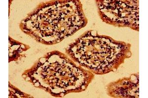 Immunohistochemistry of paraffin-embedded human small intestine tissue using ABIN7159213 at dilution of 1:100 (MC4R antibody  (AA 1-43))