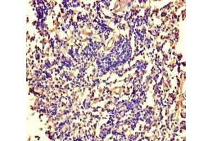 Immunohistochemistry of paraffin-embedded human tonsil tissue using ABIN7169007 at dilution of 1:100 (ARAF antibody  (AA 160-310))