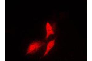 Immunofluorescent analysis of S6K1 staining in HeLa cells. (RPS6KB1 antibody  (C-Term))