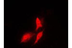 Immunofluorescent analysis of S6K1 staining in HeLa cells.