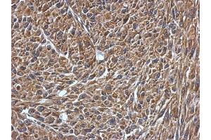 IHC-P Image Immunohistochemical analysis of paraffin-embedded U87 xenograft, using VAMP1, antibody at 1:500 dilution. (VAMP1 antibody)