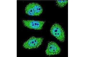 Confocal immunofluorescent analysis of PAK6 Antibody (Center) Cat. (PAK6 antibody  (Middle Region))
