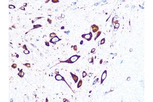 Immunohistochemistry of paraffin-embedded mouse spinal cord using FMRP Rabbit mAb (ABIN1679778, ABIN3019025, ABIN3019026 and ABIN7101703) at dilution of 1:100 (40x lens). (FMR1 antibody)
