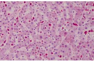 Human Liver: Formalin-Fixed, Paraffin-Embedded (FFPE) (CARD11 antibody  (AA 18-238))