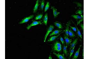 Immunofluorescent analysis of Hela cells using ABIN7159980 at dilution of 1:100 and Alexa Fluor 488-congugated AffiniPure Goat Anti-Rabbit IgG(H+L) (MAPK11 antibody  (AA 310-362))
