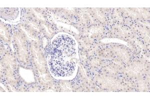 Detection of Tie1 in Human Kidney Tissue using Monoclonal Antibody to Tyrosine Kinase With Immunoglobulin Like And EGF Like Domains Protein 1 (Tie1) (TIE1 antibody  (AA 435-609))