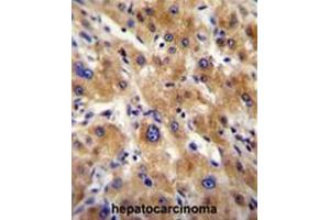 Immunohistochemistry (Paraffin-embedded Sections) (IHC (p)) image for anti-alpha-2-HS-Glycoprotein (AHSG) (AA 254-284), (C-Term) antibody (ABIN950366)