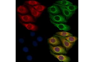ABIN7093376 and ABIN7097396 staining Hela cells by IF/ICC.