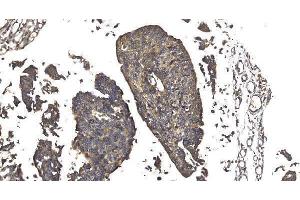 IHC analysis of Elongin-C/ELOC using anti-Elongin-C/ELOC antibody (ABIN7598951).