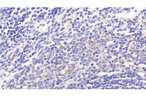 Immunohistochemistry (IHC) image for anti-Cytochrome C Oxidase Subunit II (COX2) (AA 83-227) antibody (ABIN7445771)
