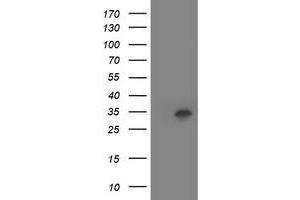 HEK293T cells were transfected with the pCMV6-ENTRY control (Left lane) or pCMV6-ENTRY HOXC11 (Right lane) cDNA for 48 hrs and lysed. (HOXC11 antibody)