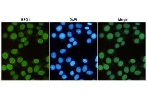 Immunocytochemistry (ICC) image for anti-SWI/SNF Related, Matrix Associated, Actin Dependent Regulator of Chromatin, Subfamily A, Member 4 (SMARCA4) antibody (ABIN6241307)