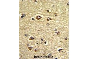 Immunohistochemistry (IHC) image for anti-Growth Arrest-Specific 7 (GAS7) antibody (ABIN3002729) (GAS7 antibody)