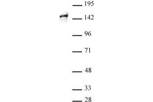 STAG1 antibody (pAb) tested by Western blot. (Stromal Antigen 1 antibody  (C-Term))