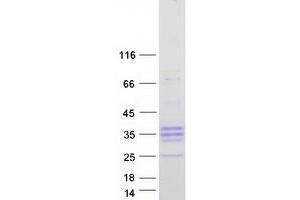 PRSS55 Protein (Transcript Variant 2) (Myc-DYKDDDDK Tag)