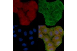 ABIN6258807 and ABIN6273863 staining Hela cells(30 min of UV treatment) by IF/ICC. (GPR25 antibody  (Internal Region))