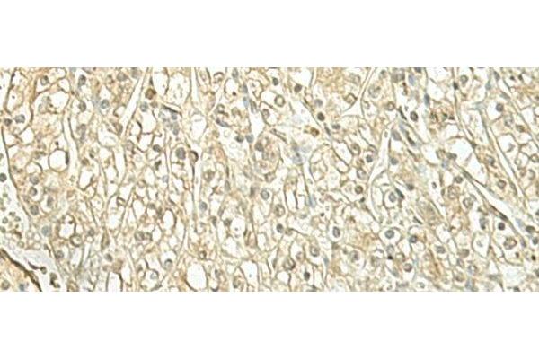 SPIRE1 antibody
