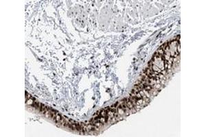 Immunohistochemical staining of human bronchus with MCART6 polyclonal antibody  shows strong nuclear positivity in respiratory epithelial cells. (MCART6 antibody)