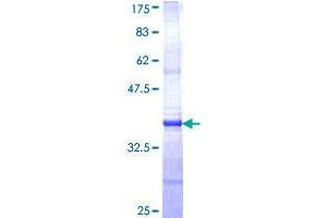 Image no. 1 for Cystinosis, Nephropathic (CTNS) (AA 1-100) protein (GST tag) (ABIN1350684) (CTNS Protein (AA 1-100) (GST tag))