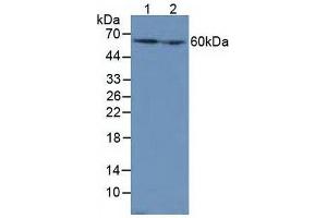 Western blot analysis of (1) Mouse Liver Tissue and (2) Mouse Kidney Tissue. (Catalase antibody  (AA 32-157))