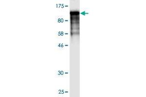 Western Blot detection against Immunogen (117. (Filamin A antibody  (AA 1-838))