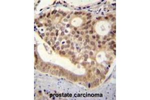 C11orf53 antibody (C-term) immunohistochemistry analysis in formalin fixed and paraffin embedded human pancreas tissue followed by peroxidase conjugation of the secondary antibody and DAB staining. (C11orf53 antibody  (C-Term))