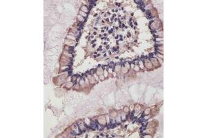 (ABIN6242485 and ABIN6578840) staining NRAS in human small intestine tissue sections by Immunohistochemistry (IHC-P - paraformaldehyde-fixed, paraffin-embedded sections). (GTPase NRas antibody)