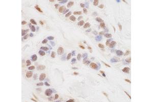 anti-CREB Regulated Transcription Coactivator 3 (CRTC3) (AA 569-619) antibody