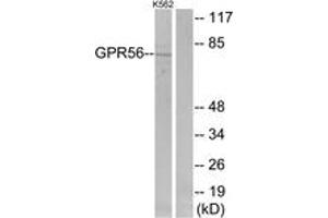 Western Blotting (WB) image for anti-G Protein-Coupled Receptor 56 (GPR56) (AA 251-300) antibody (ABIN2890875) (GPR56 antibody  (AA 251-300))