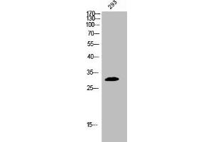 Western Blot analysis of 293 cells using Phospho-BAM32 (Y139) Polyclonal Antibody (DAPP1 antibody  (pTyr139))
