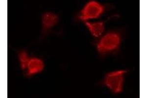 ABIN6277893 staining Hela by IF/ICC. (ERN1 antibody  (Internal Region))