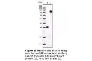 Image no. 2 for anti-Bruton Agammaglobulinemia tyrosine Kinase (BTK) antibody (ABIN232137) (BTK antibody)