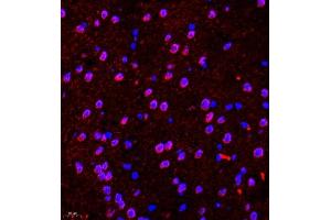 Immunohistochemistry of paraffin embedded mouse brain using CDH19 (ABIN7073258) at dilution of 1:500 (400x lens) (CDH19 antibody)
