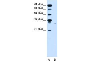 WB Suggested Anti-SLC22A7 Antibody Titration:  0.