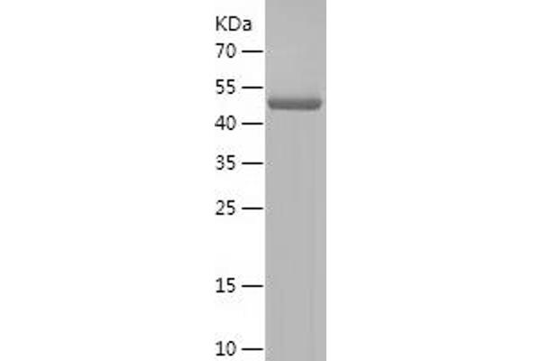 POMC Protein (AA 27-267) (His-IF2DI Tag)