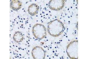 Immunohistochemistry of paraffin-embedded Human stomach using CABP7 Polyclonal Antibody at dilution of 1:100 (40x lens). (CABP7 antibody)
