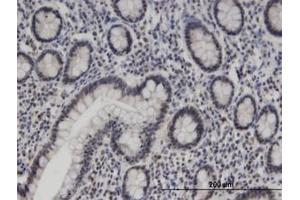 Image no. 1 for anti-Zinc Finger Protein 138 (ZNF138) (AA 151-251) antibody (ABIN599468) (ZNF138 antibody  (AA 151-251))