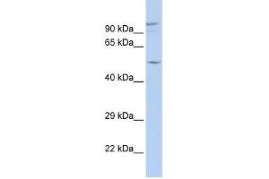 GJA3 antibody used at 1 ug/ml to detect target protein. (GJA3 antibody  (N-Term))