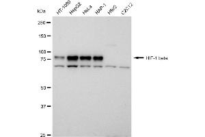 Western blotting analysis using HIF 1 beta antibody (ABIN7797657).